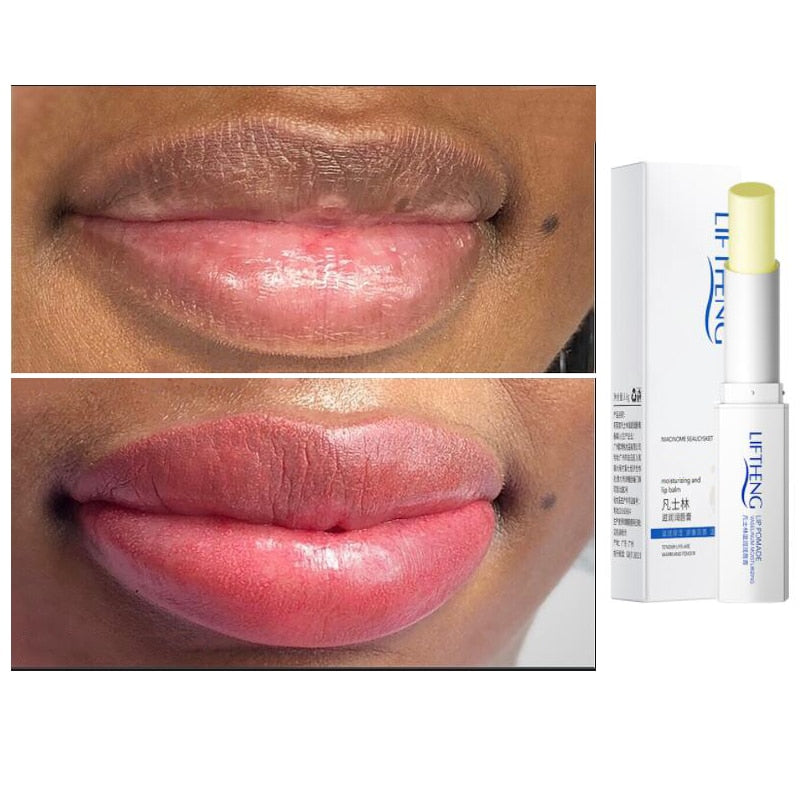 Herbal Dark Lip Removal Balm 
Eliminate Uneven Darkness on Lips Fast Results